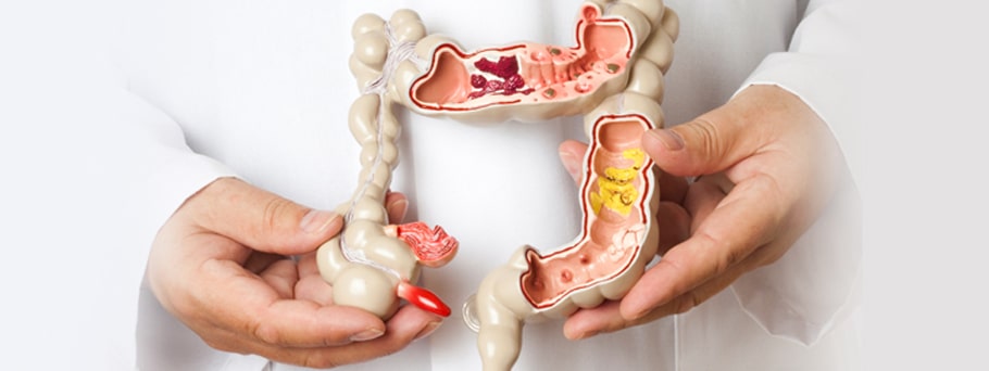 The Excellence of Colorectal Surgery in Delhi by Top-Colorectal Surgeons